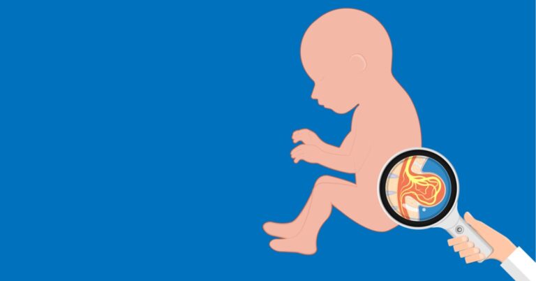 مرض الصلب المشقوق