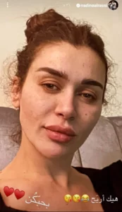 نادين الراسي بـ وجه شاحب وبشرة باهتة..شاهد
