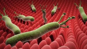 أسباب الإصابة بالجرثومة الحلزونية وطرق العلاج وعلاقتها بالسرطان