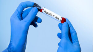 مصر تنجح في التحول من الدولة الأكثر انتشارا لفيروس سي لاول دولة تقضي علي المرض