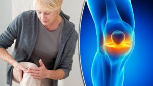 الاضطراب في الأكل والتدخين.. تعرف على أسباب هشاشة العظام