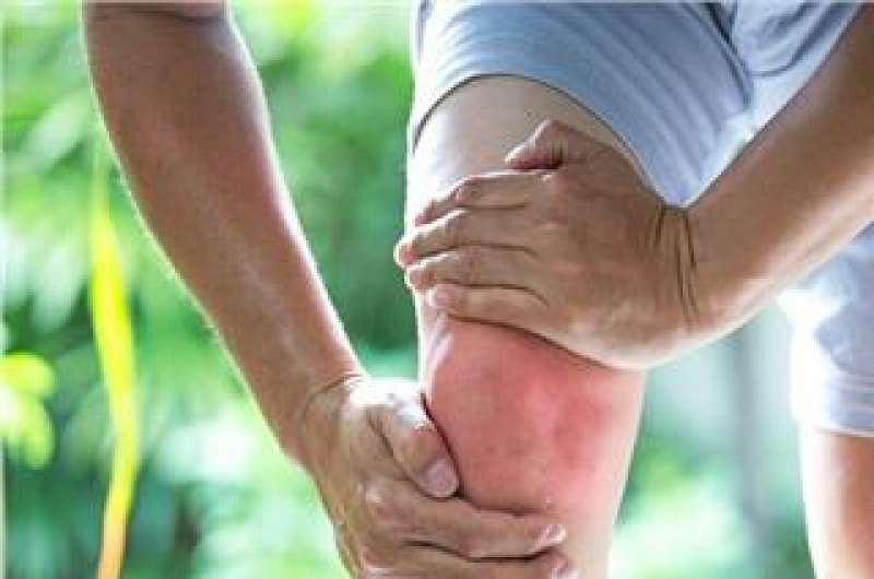 التهاب المفاصل.. أسباب تساعد على تقليل الإصابة.. تعرف عليها