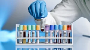 52.8 % ارتفاعًا في أرباح سيتي للتحاليل الطبية خلال 9 أشهر