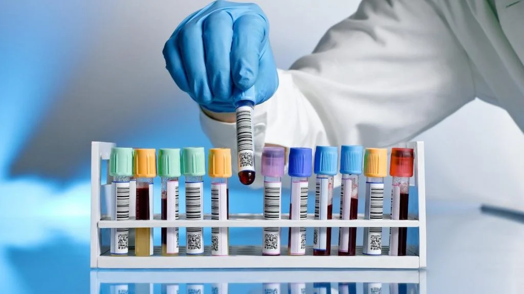 تابعة لـ سيتي للتحاليل الطبية توقع اتفاقية مساهمين مع مختبرات القضاة التخصصية الأردنية