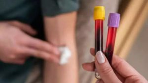 بعد التبرع المتكرر.. علامات وأعراض “أنيميا” فقر الدم