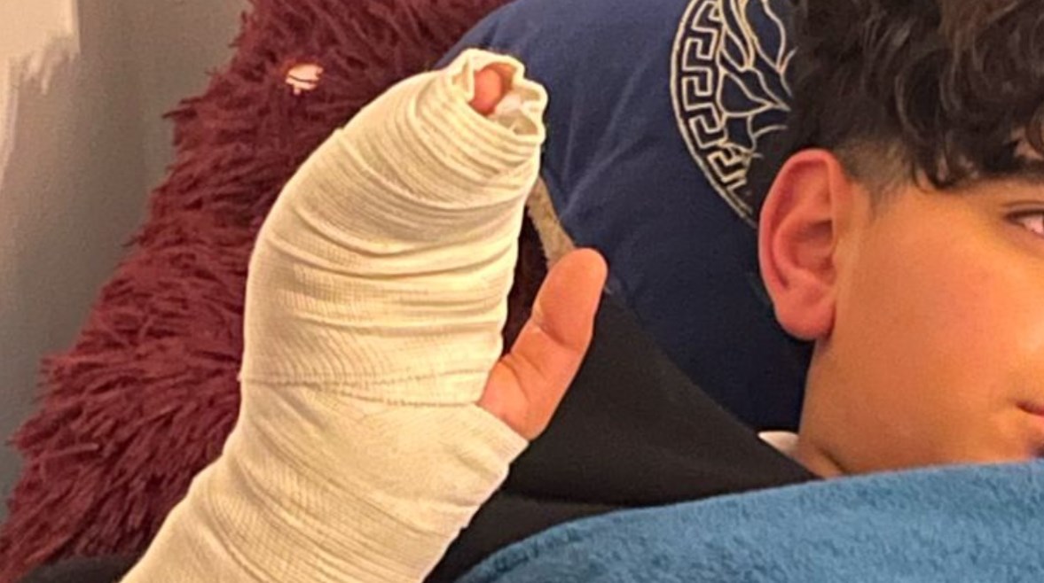 بسبب الصلاة.. مدرس يعتدي على طالب ويكسر ذراعه داخل مدرسة دولية ببدر