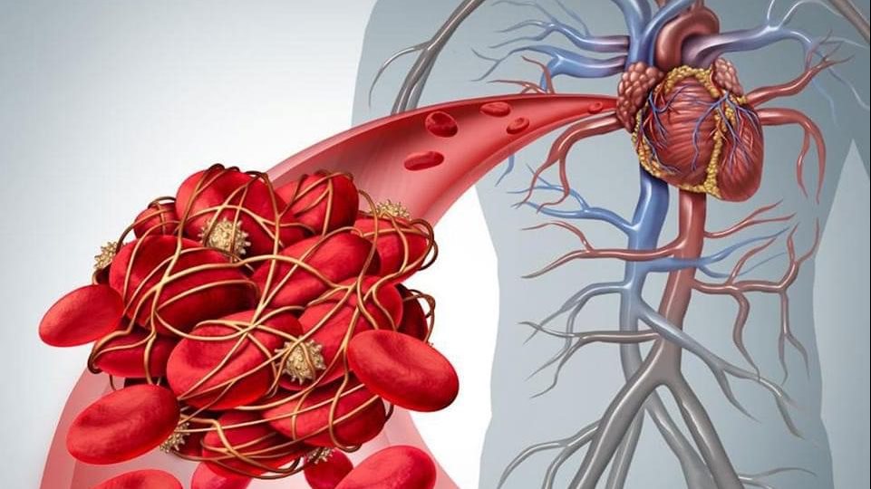 4 مشروبات طبيعية تحميك من خطر الجلطات المفاجئة وتحسن صحة قلبك