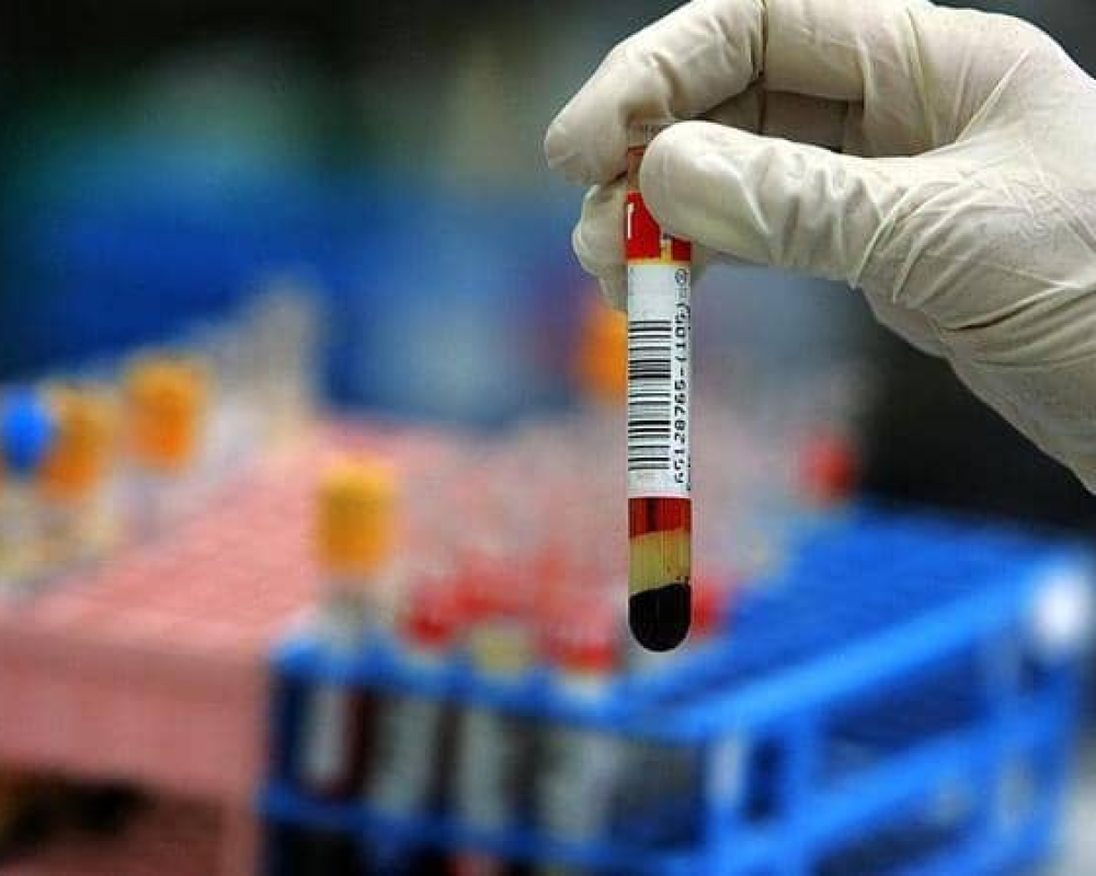 دراسة علمية تبرئ شبكات الاتصال من السرطان