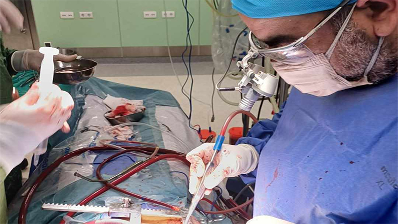 تفعيل خدمة القسطرة المخية بمستشفى دمنهور التعليمي بالبحيرة