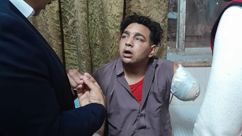 تأجيل قضية “عامل سيرك طنطا” ضد أنوسة كوتة لـ14 يونيو