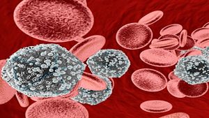 سيدة قنا أعادته للساحة.. 1% نسبة الإصابة بالإيدز في مصر