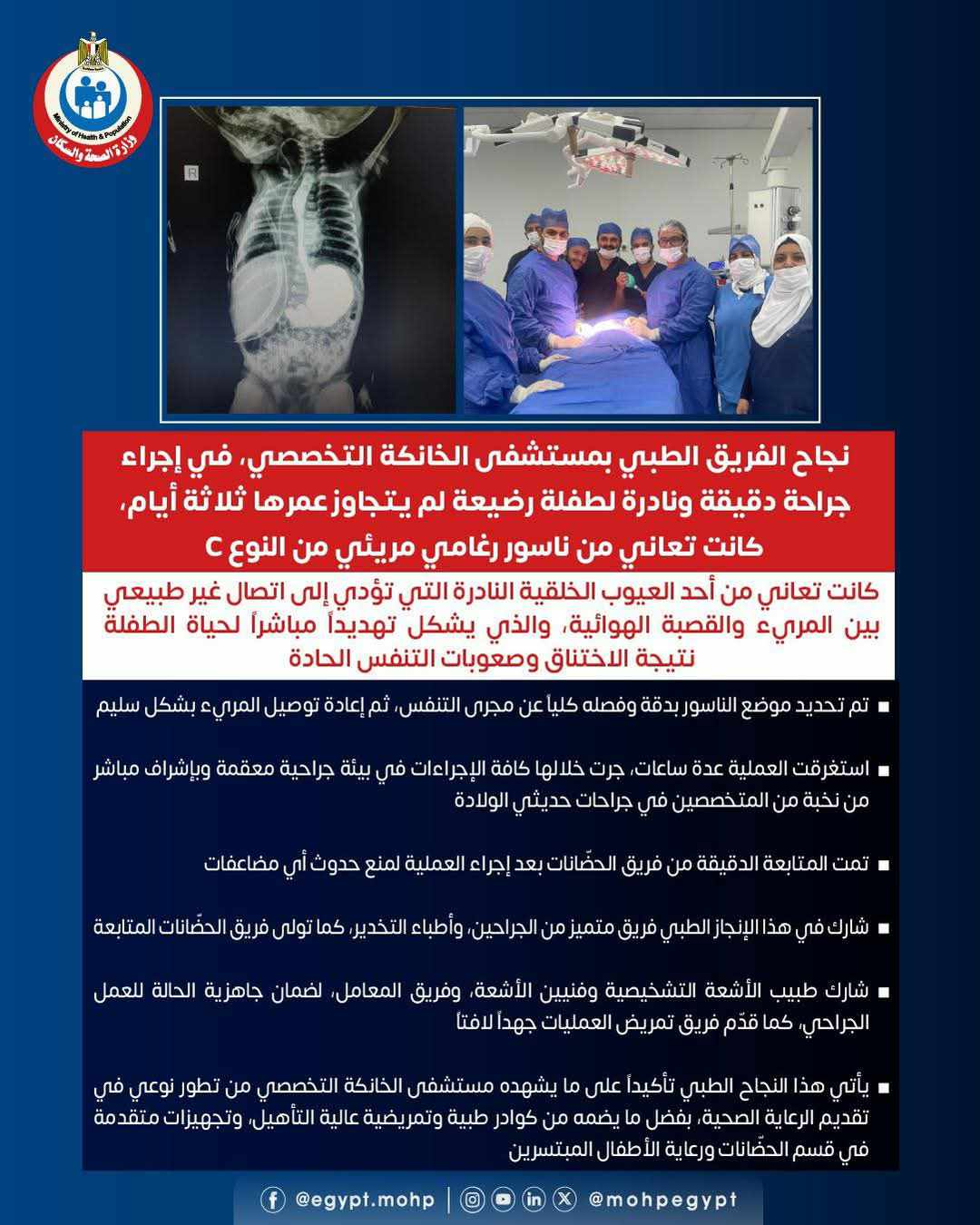 نجاح جراحة دقيقة لرضيعة في مستشفى الخانكة