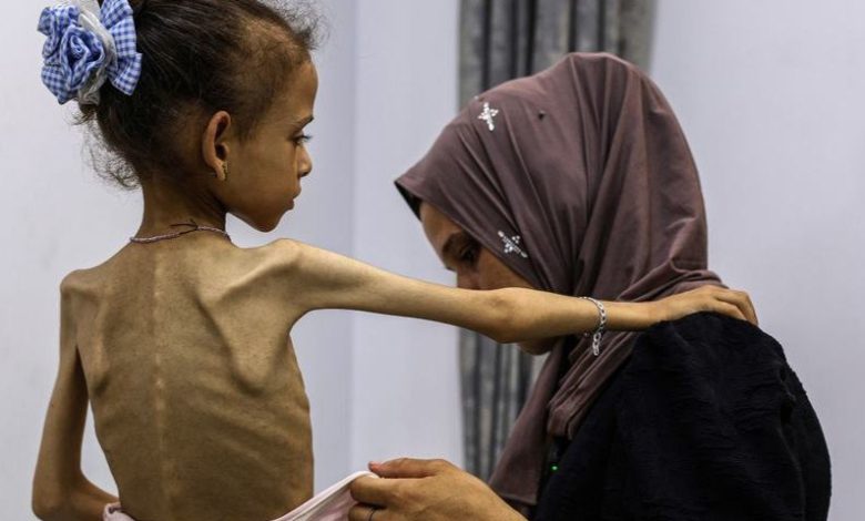 دعوات أممية لوقف إطلاق النار في غزة وسط تفاقم الأزمة الصحية