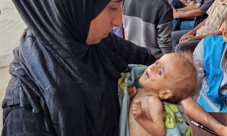 «الأونروا» تحذر: غزة على حافة الكارثة الإنسانية