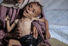 نداء عاجل من الأونروا: «أوقفوا التجويع في غزة»
