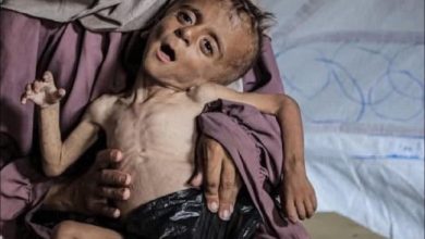نداء عاجل من الأونروا: «أوقفوا التجويع في غزة»