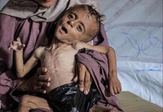 نداء عاجل من الأونروا: «أوقفوا التجويع في غزة»