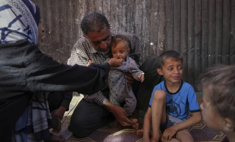 شهداء وإصابات بالمئات والمجاعة تفتك بالأطفال في غزة