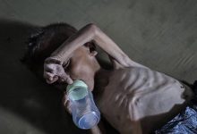 3 وفيات بـ«غيلان باريه» بغزة.. والصحة تحذر