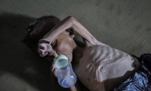 3 وفيات بـ«غيلان باريه» بغزة.. والصحة تحذر