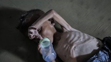 3 وفيات بـ«غيلان باريه» بغزة.. والصحة تحذر