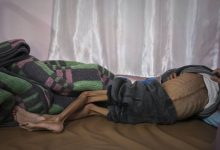 الأونروا: الجوع أصبح القاتل الأحدث في غزة
