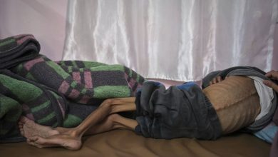 الأونروا: الجوع أصبح القاتل الأحدث في غزة