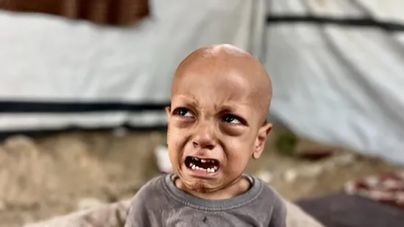 وفاة الطفل الفلسطيني صاحب مقولة “أنا جعان”