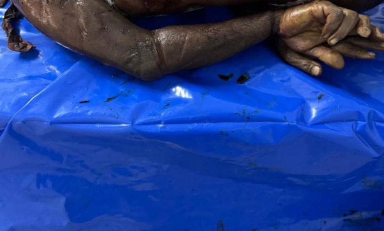 صحة غزة: الاحتلال يعيد 15 جثمانًا بعضها عليها علامات تنكيل