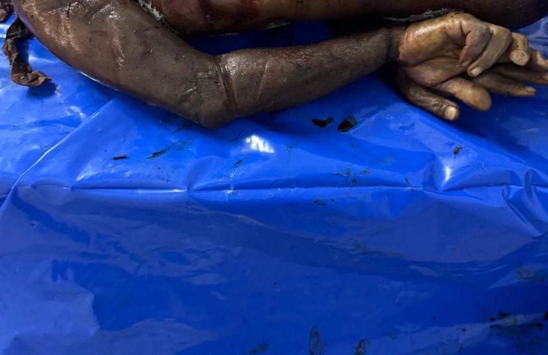 صحة غزة: الاحتلال يعيد 15 جثمانًا بعضها عليها علامات تنكيل