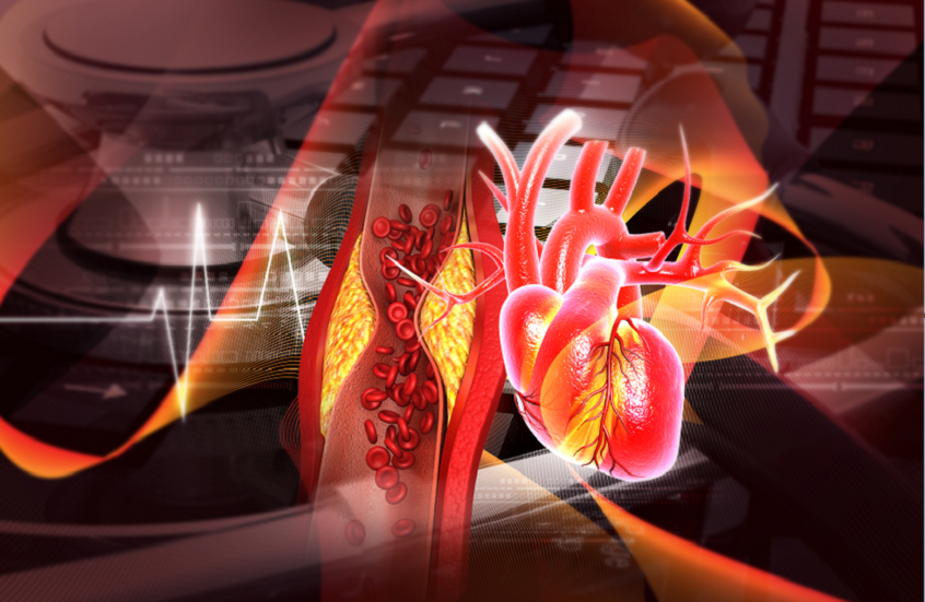 ارتفاع كوليسترول الدم.. كيف يتحول الغذاء إلى تهديد للقلب؟