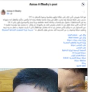 القبض على مدرس لتعديه على طالب بعصا خشبية داخل مدرسة بدمياط