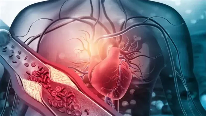 كل ما تريد معرفته عن هبوط القلب والذبحة الصدرية