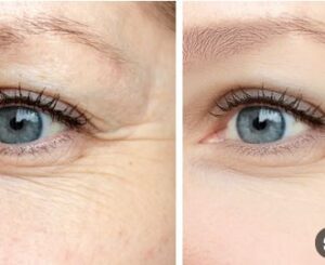 من مطبخك إلى بشرتك.. مادة طبيعية تقضي على التجاعيد والبقع والحبوب