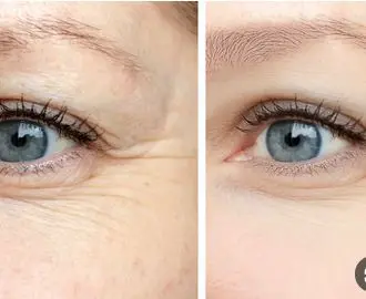 من مطبخك إلى بشرتك.. مادة طبيعية تقضي على التجاعيد والبقع والحبوب