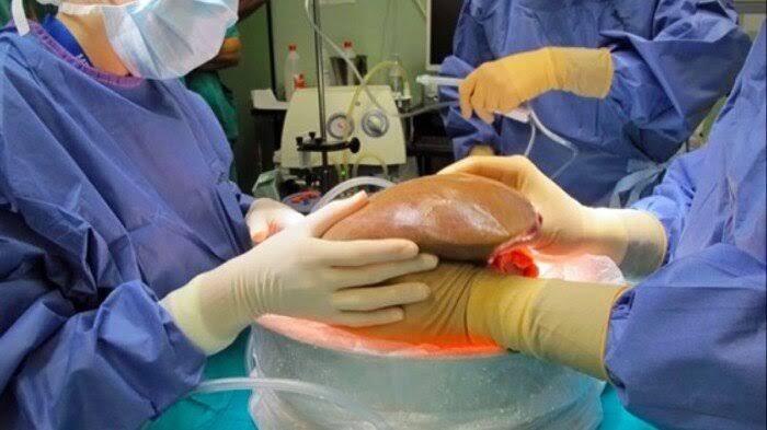 «نجاح زراعة الكبد بتقنيات الطب «عن بُعد» لتوظيف التكنولوجيا في التخصصات الطبية الدقيقة