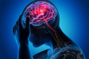 دراسة دولية تكشف: العوامل البيئية والاجتماعية تسرع شيخوخة الدماغ أكثر من الأمراض